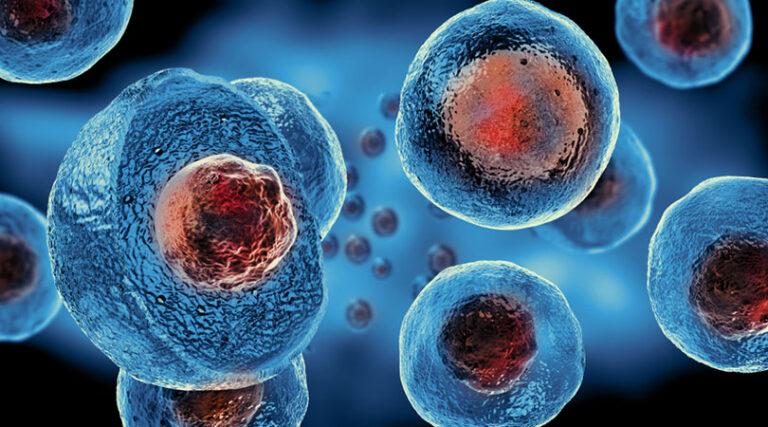 How Stem Cell Therapy