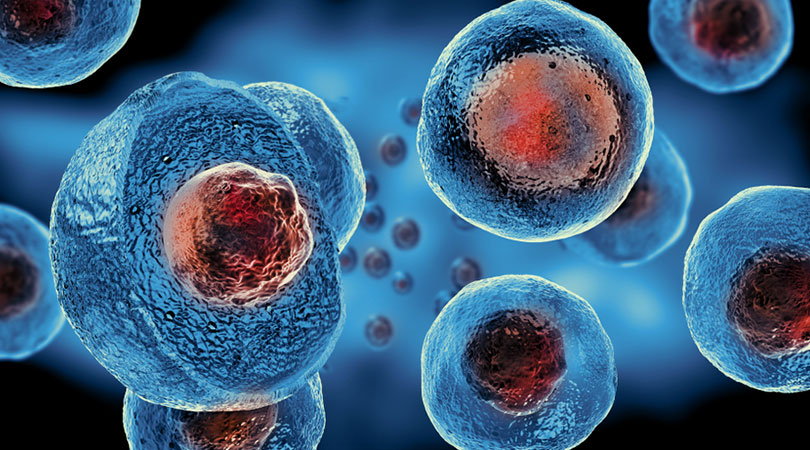 How Stem Cell Therapy