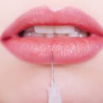 Lip Fillers in Toms River