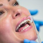 Dental Fillings
