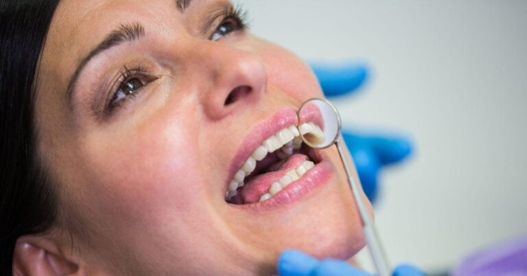 Dental Fillings